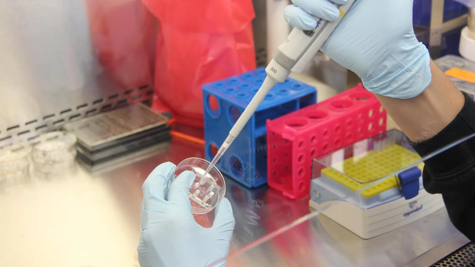 Peste polmonare, i sintomi, il contagio le cure: tutto quello che c'è da sapere