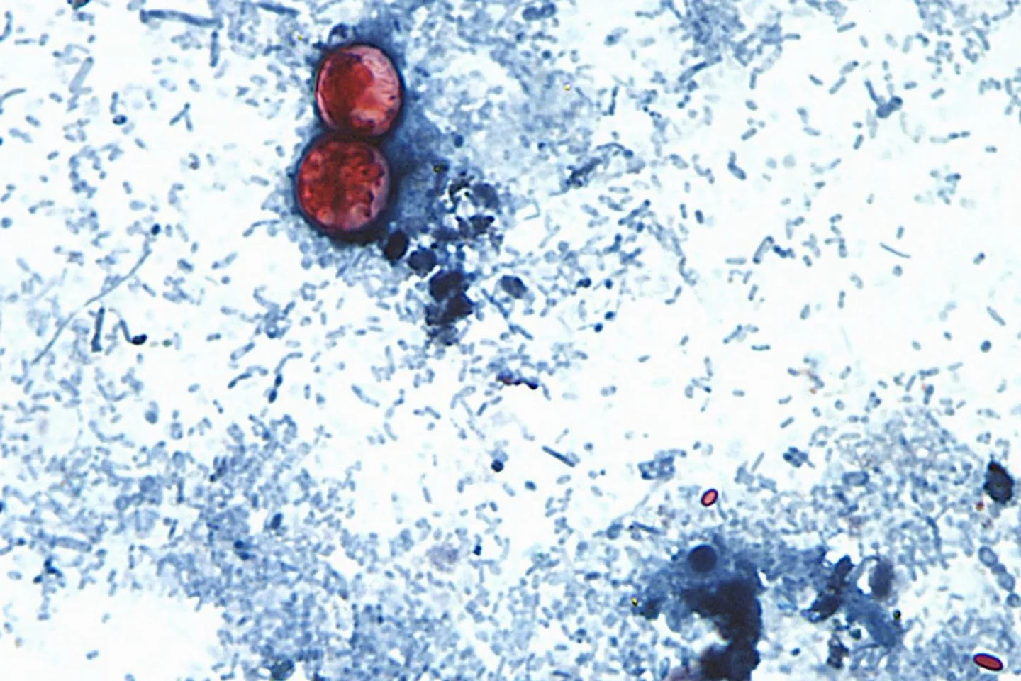 Cyclospora fears force lettuce farmers to plow fields under