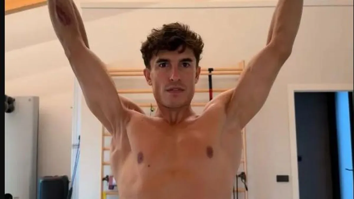 Marc Marquez mostra la spalla destra operata 7 volte: la foto su Instagram fa impressione