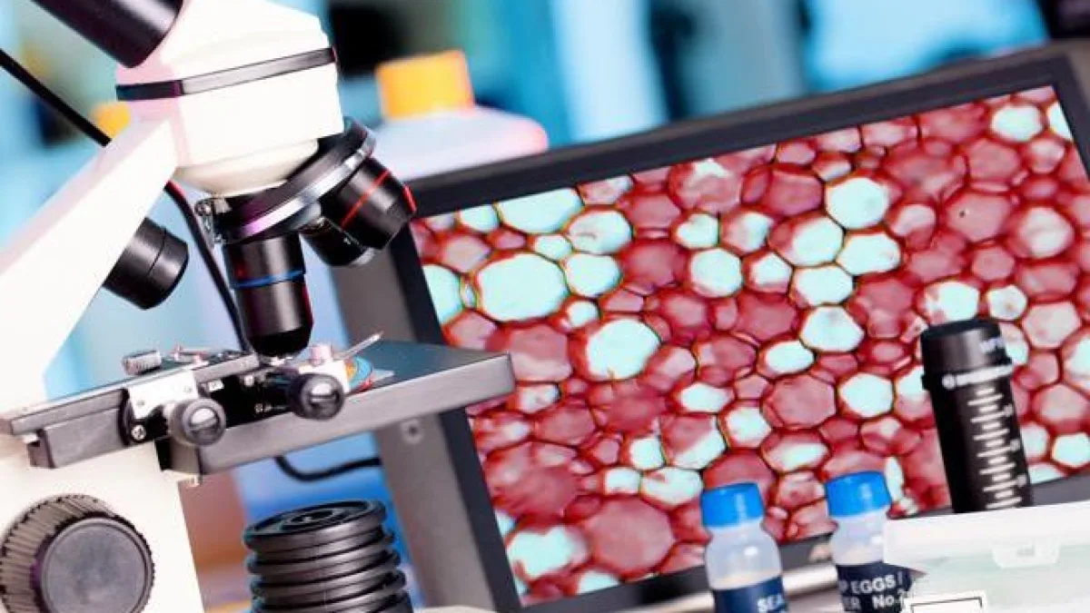 Tumore del colon: chi ha bisogno della chemioterapia post-operatoria? Lo studio