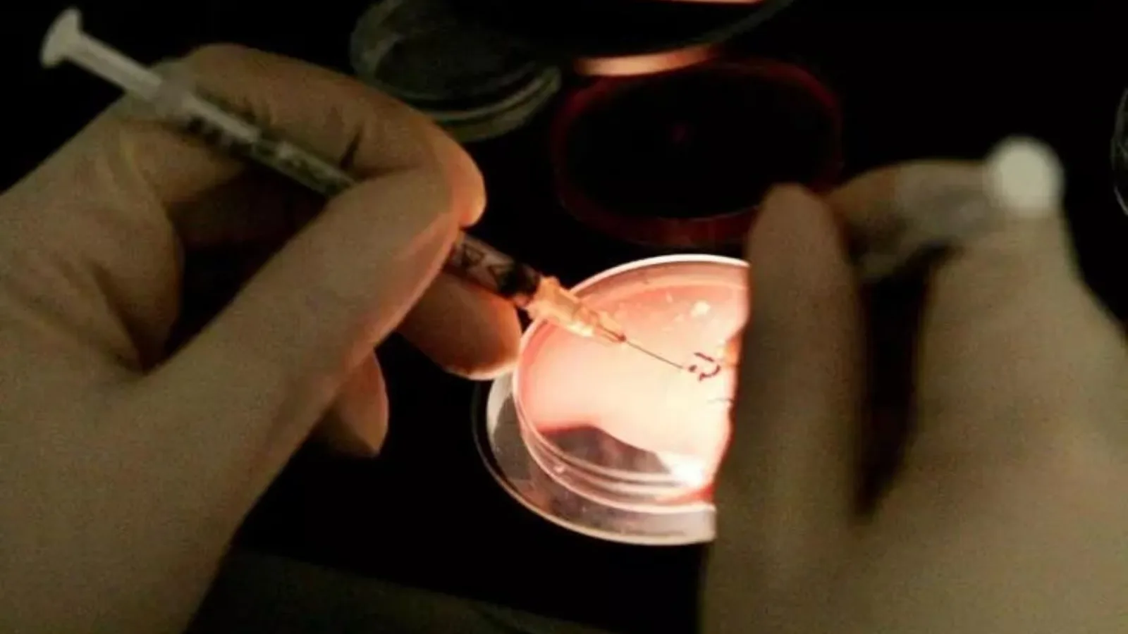 Peste in laboratorio russo, quali rischi reali e sospetti